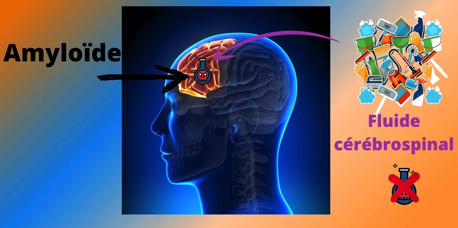 L'amyloïde responsable de la maladie d'Alzheimer est détruite par le nettoyage effectuer pendant la phase du sommeil profond